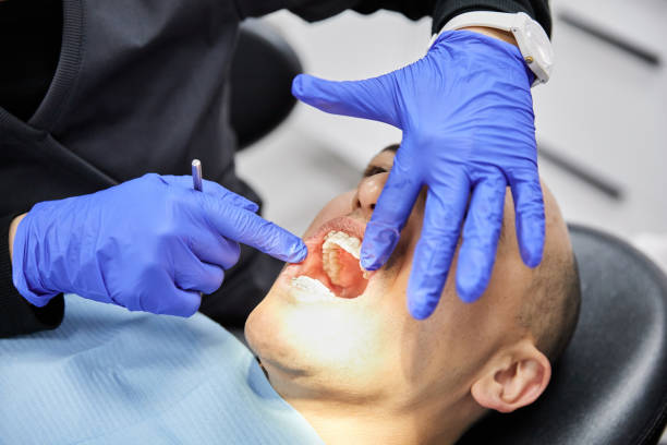 Best Knocked-Out Tooth (Avulsed Tooth) Treatment in Crystal Springs, MS